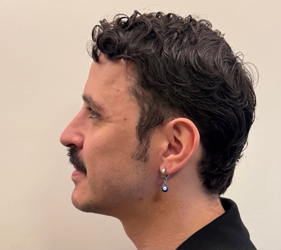 resultado masculino, perfil, antes do tratamento